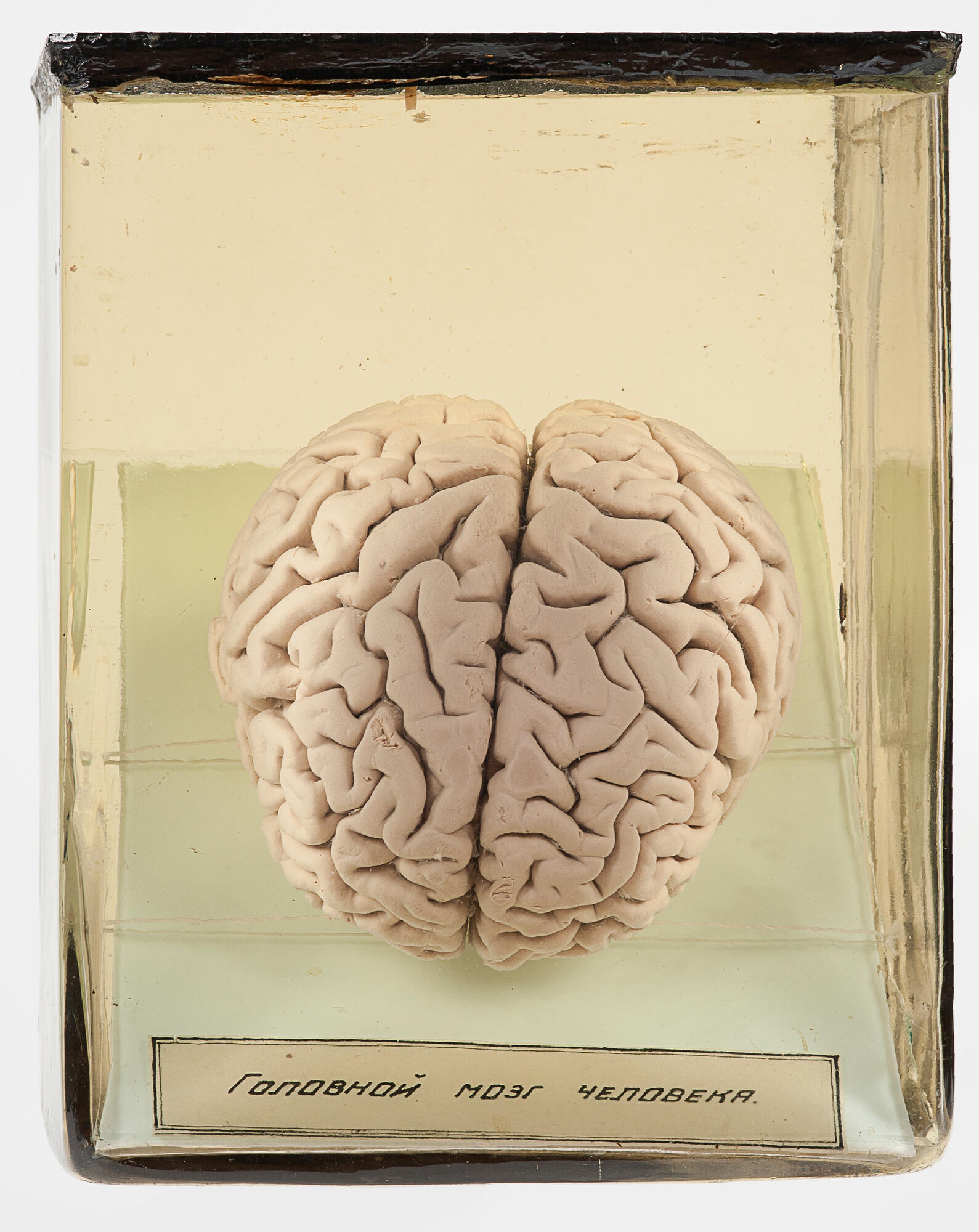 Мозг человека. Подробное описание экспоната, аудиогид, интересные факты.  Официальный сайт Artefact