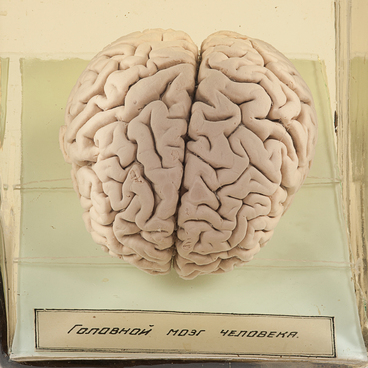 Human brain