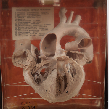 Opened human heart