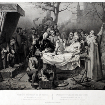 Earliest Operation for the Stone